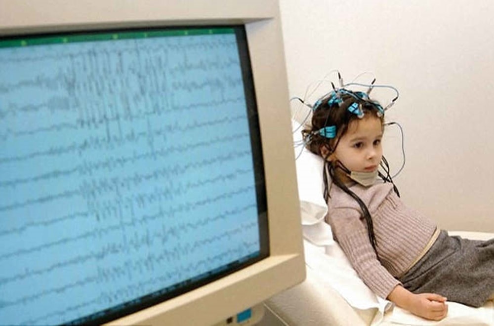 Bening Rolandik Epilepsisi Hakkında