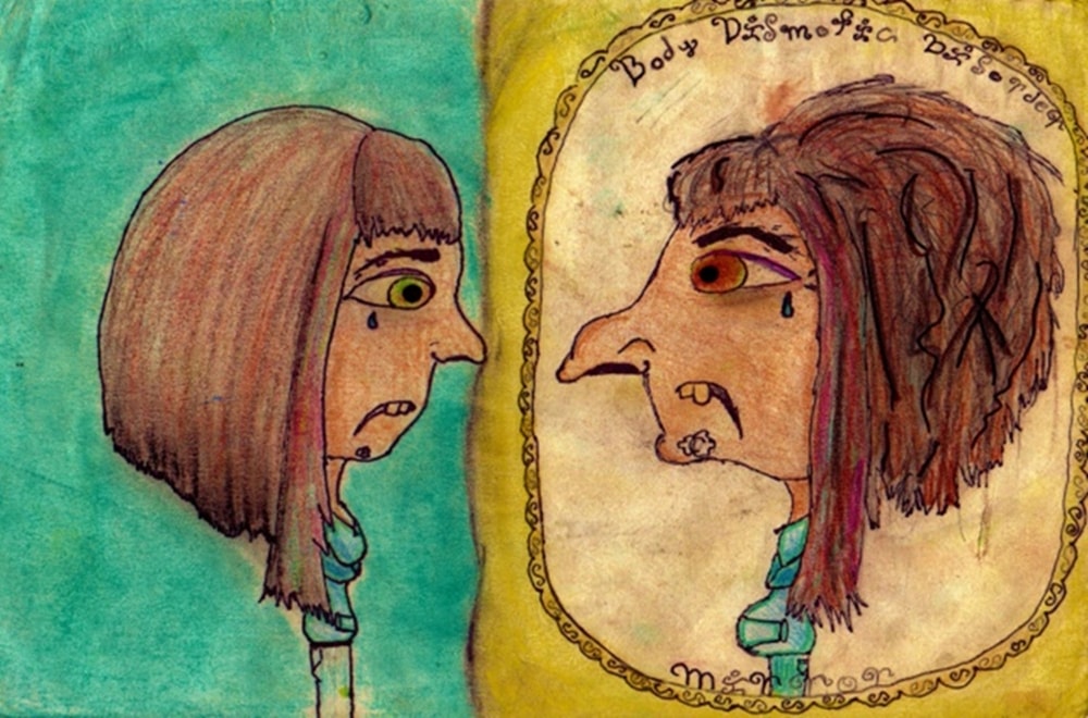 Beden İmajında Bozulma Nedir?