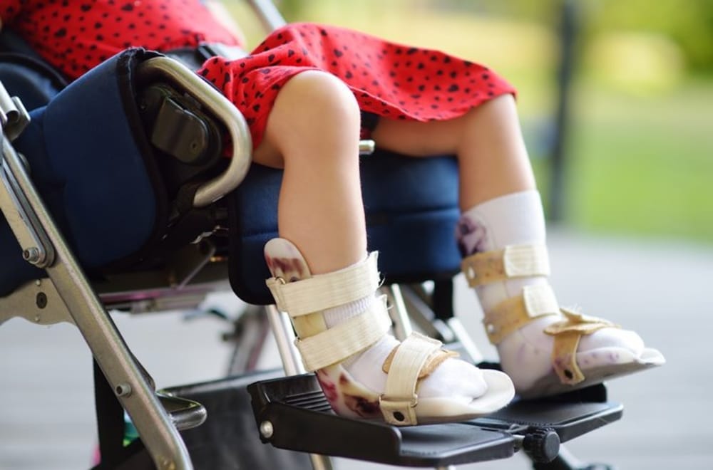 Serebral Palsi Nedir?