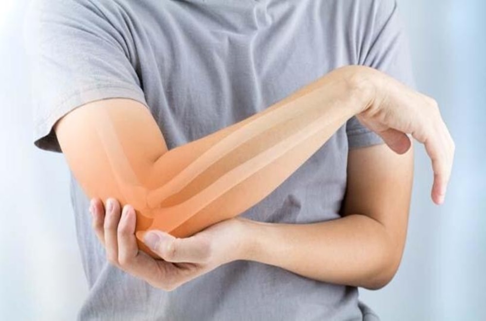Ulnar Sinir Sıkışması Nedir?