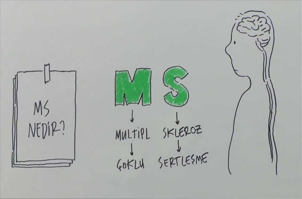 Multipl Sklerozun (MS) Zihinsel Etkilerinin Yönetim Rehberi